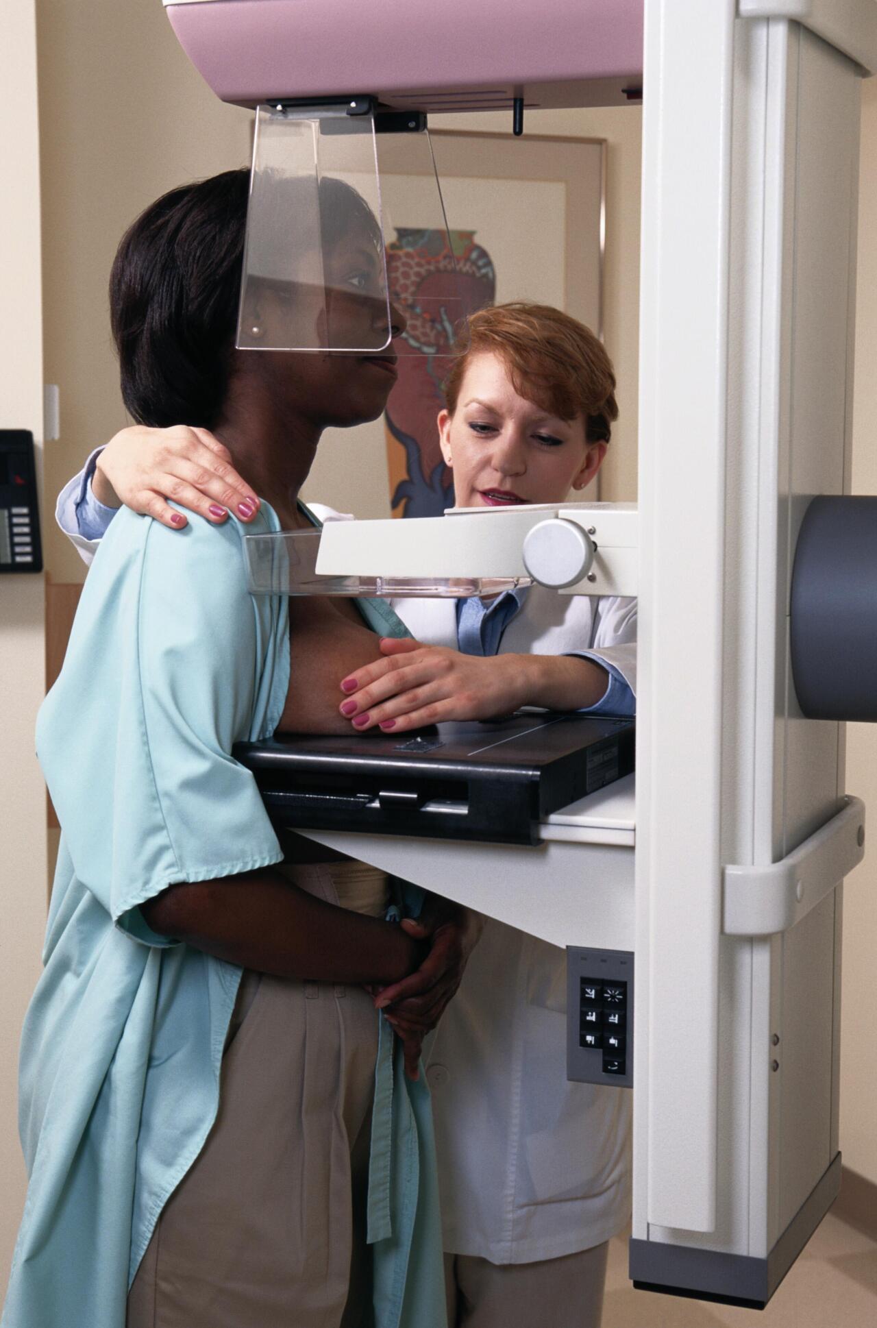 Mamografia, X izpietan oinarritutako ohiko diagnosi-teknika