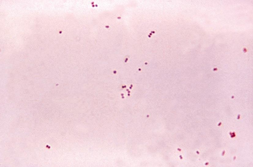 <span style="font-style:italic">Neisseria meningitidis </span>diplokoko-bakterio gram-negatibo aerobioak; Mag. 1150X
